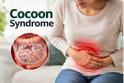  Cocoon Syndrome