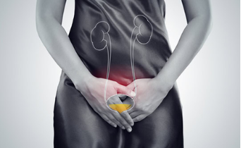  Urinary Tract Infection